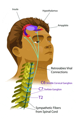 Patient positioned for the neurolytic blocks procedure at Indo British Advanced Pain Clinic